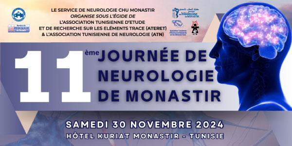 Service de Neurologie CHU Monastir